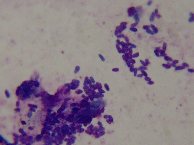 ��ĸ���Զ���