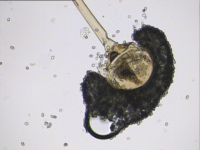 ���B�ӵ���X���@΢�R